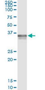 ADAMTS4 Antibody in Immunoprecipitation (IP)