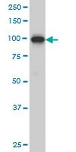 ADAMTS2 Antibody in Western Blot (WB)