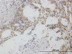 POLR1C Antibody in Immunohistochemistry (Paraffin) (IHC (P))