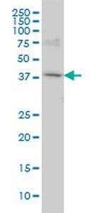 POLR1C Antibody in Western Blot (WB)