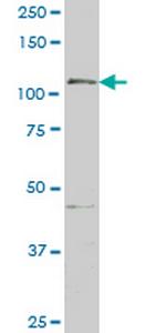 GTF2IRD1 Antibody in Western Blot (WB)