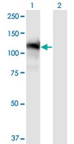 GTF2IRD1 Antibody in Western Blot (WB)