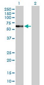 ENTPD4 Antibody in Western Blot (WB)