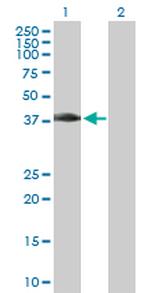 MAD2L1BP Antibody in Western Blot (WB)