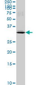 MAD2L1BP Antibody in Western Blot (WB)