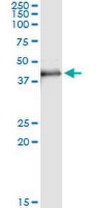 MAD2L1BP Antibody in Immunoprecipitation (IP)