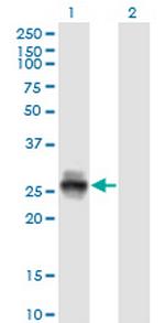 KLK4 Antibody in Western Blot (WB)