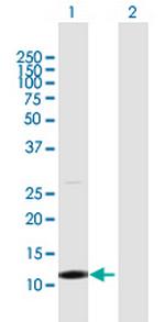 TCL1B Antibody in Western Blot (WB)