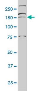 AATK Antibody in Western Blot (WB)