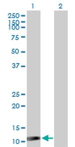 ISG15 Antibody in Western Blot (WB)