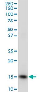 ISG15 Antibody in Western Blot (WB)