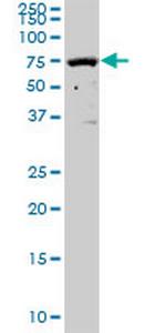 SOCS5 Antibody in Western Blot (WB)