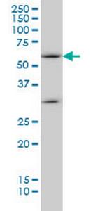 SOCS5 Antibody in Western Blot (WB)