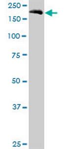 EIF5B Antibody in Western Blot (WB)