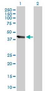 UBE3C Antibody in Western Blot (WB)