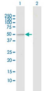 UBE3C Antibody in Western Blot (WB)