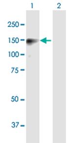 SAPS2 Antibody in Western Blot (WB)