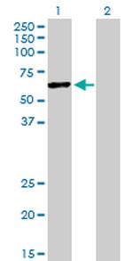 HERPUD1 Antibody in Western Blot (WB)