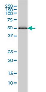 HERPUD1 Antibody in Western Blot (WB)