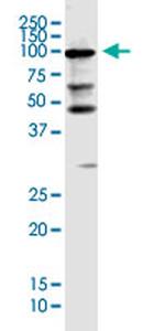 KIAA0226 Antibody in Western Blot (WB)