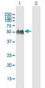 GPRIN2 Antibody in Western Blot (WB)