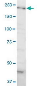 DOCK4 Antibody in Western Blot (WB)