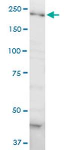 DOCK4 Antibody in Western Blot (WB)