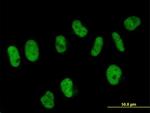 SART3 Antibody in Immunocytochemistry (ICC/IF)