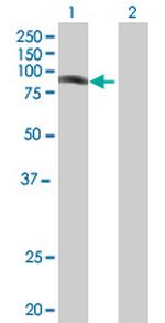 PHF16 Antibody in Western Blot (WB)