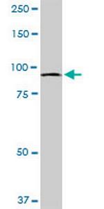 MTSS1 Antibody in Western Blot (WB)