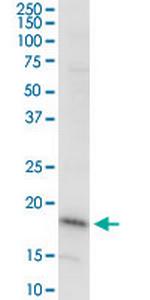 DAZAP2 Antibody in Western Blot (WB)