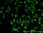 TOMM20 Antibody in Immunocytochemistry (ICC/IF)