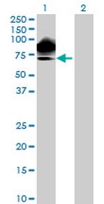 KIAA0494 Antibody in Western Blot (WB)