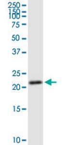 GINS1 Antibody in Western Blot (WB)