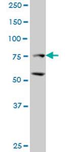 ZFHX1B Antibody in Western Blot (WB)