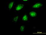 SETDB1 Antibody in Immunocytochemistry (ICC/IF)