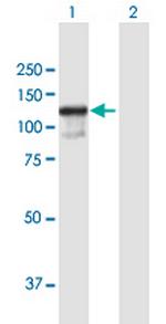 ZC3H11A Antibody in Western Blot (WB)
