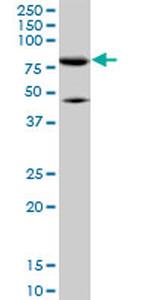 MFN2 Antibody in Western Blot (WB)