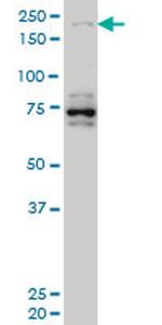 HELZ Antibody in Western Blot (WB)