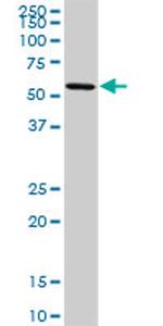 OXSR1 Antibody in Western Blot (WB)