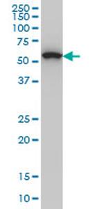 OXSR1 Antibody in Western Blot (WB)