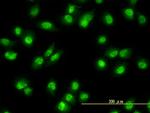 NR1D2 Antibody in Immunocytochemistry (ICC/IF)