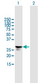 FGFBP1 Antibody in Western Blot (WB)