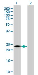 FGFBP1 Antibody in Western Blot (WB)