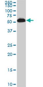 AKT3 Antibody in Western Blot (WB)