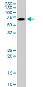 AKT3 Antibody in Western Blot (WB)