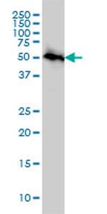 AKT3 Antibody in Western Blot (WB)