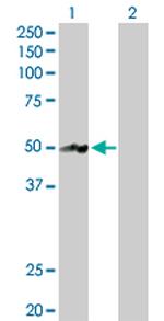 NR2E3 Antibody in Western Blot (WB)