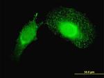 PDCD6IP Antibody in Immunocytochemistry (ICC/IF)