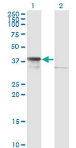 DNAJB6 Antibody in Western Blot (WB)